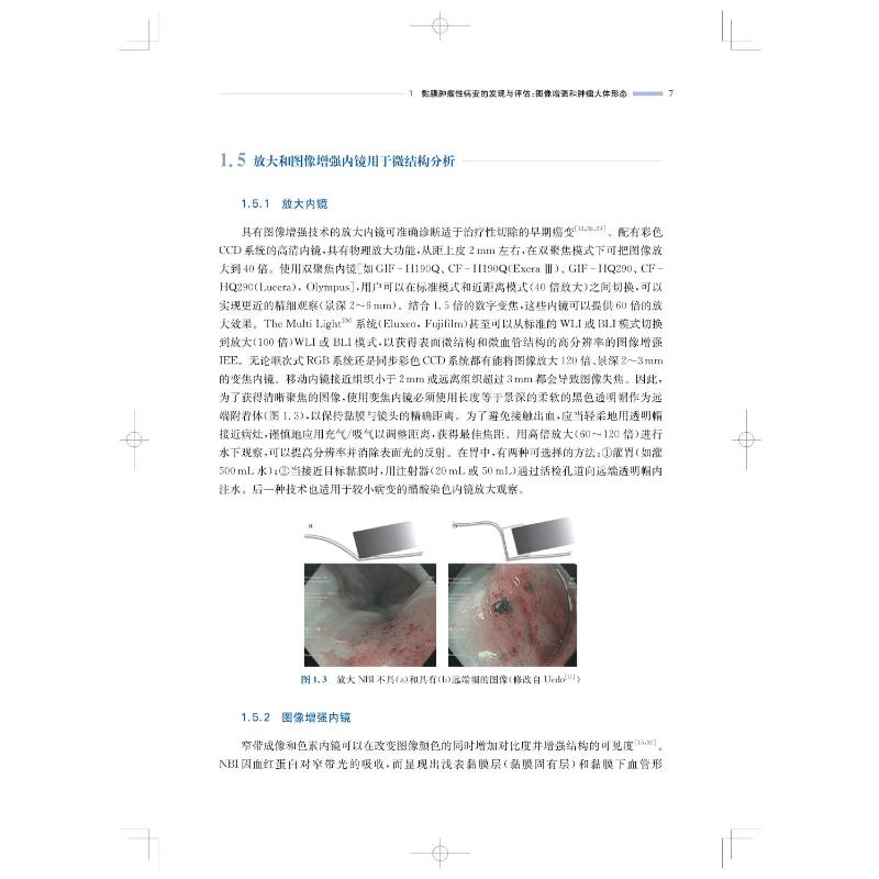 [正版]早期胃肠道肿瘤内镜诊治决策图谱 (奥)弗里德·贝尔 等 编 李连勇,钟长青 译 内科学生活 书店图书籍 上海科学高清大图