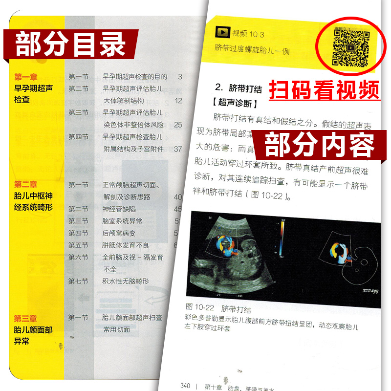 [正版] 产前超声掌中宝 主编邓学东 医学影像临床案例解读教程 产科指南速查手册 妇产科学参考工具书 人民卫生出版社9高清大图