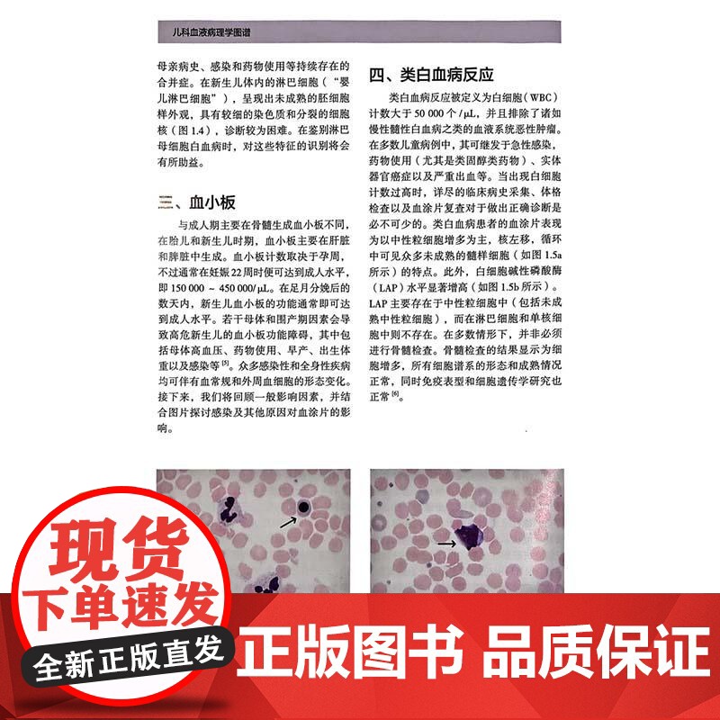 儿科血液病理学图谱 系统阐述了各类儿科血液病的病理特征等 王艳芬 吴泽霖 刘黎琼 曹娟 主译 辽宁科学技术出版社978高清大图