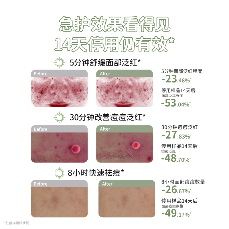 袋鼠妈妈青少年安肌祛痘修护精华液2.0版-15g(两支)高清大图