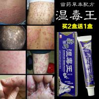藏药湿毒王药膏苗药牛皮癣立克大腿内侧瘙痒股癣药膏汗斑藓白斑私处龟头炎外阴止痒肛门肛周湿疹皮炎鹅掌风手癣脱皮脚毛囊炎18克