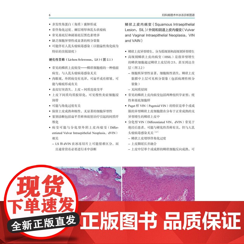 妇科病理术中冰冻诊断图谱 妇科医学 妇科肿瘤治疗 病理 临床特征 北京科学技术高清大图