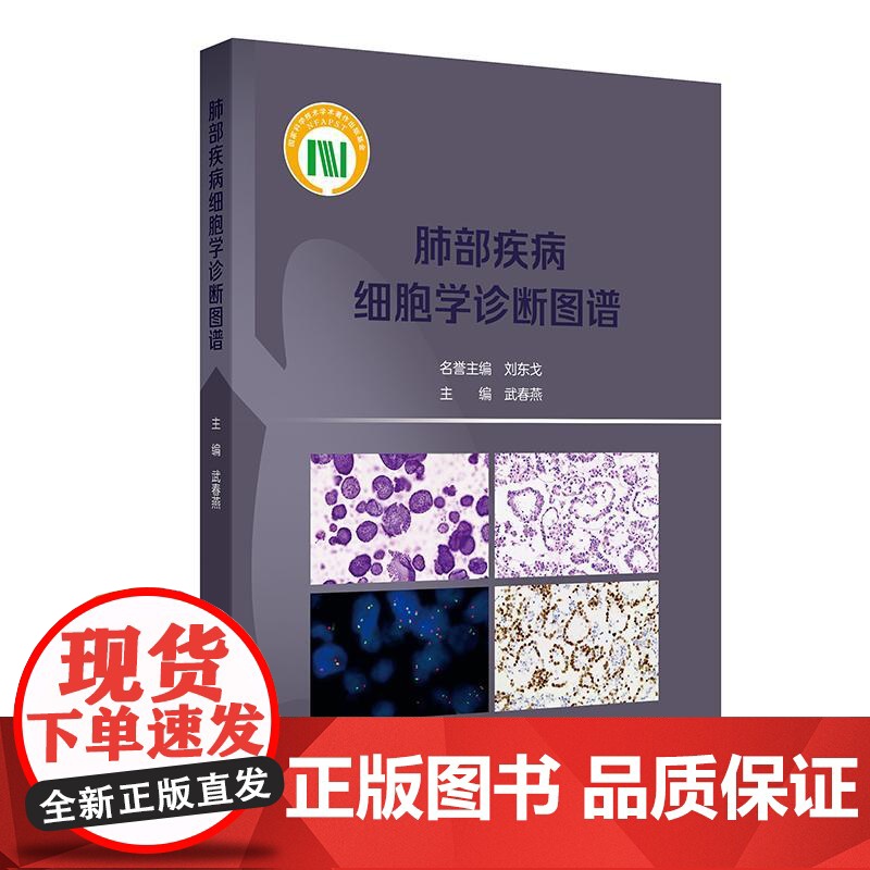 肺部疾病细胞学诊断图谱 武春燕 介绍了肺部疾病的液基细胞学诊断方法 呼吸科肿瘤科病理科等相关专业临床医务人员 人民卫生出高清大图