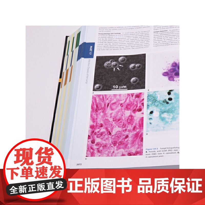 [央视网]Fishman肺部疾病第5版英文版 呼吸医学中的翘楚之作 是呼吸科临床医生 实习生 肺部疾病研究人员必不可少的高清大图