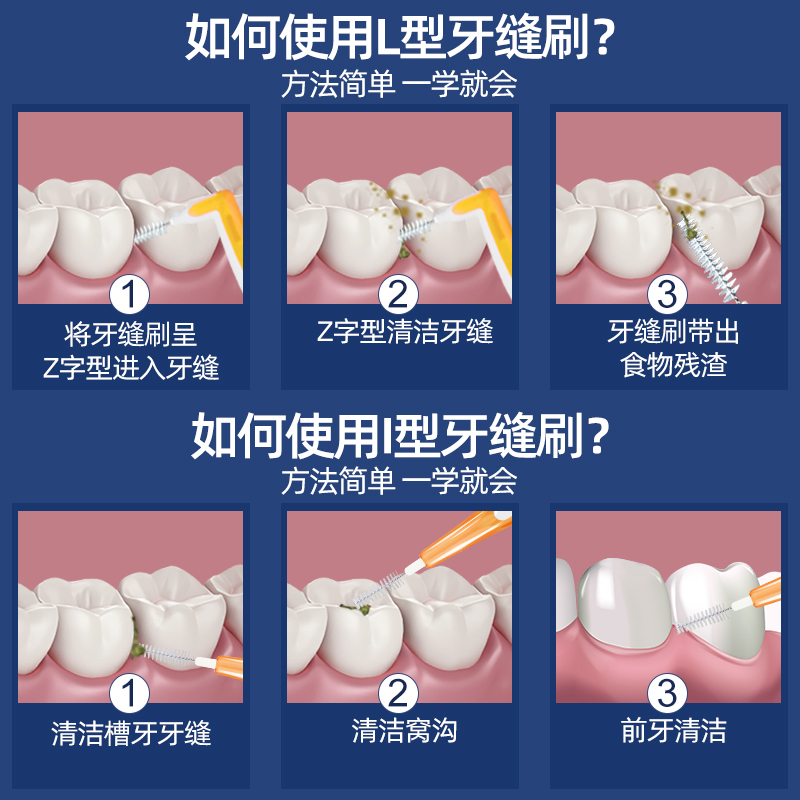 小鹿妈妈(FAWN MUM)经典L型牙缝刷间隙刷牙间刷0.7mm/SSS号 5支/袋