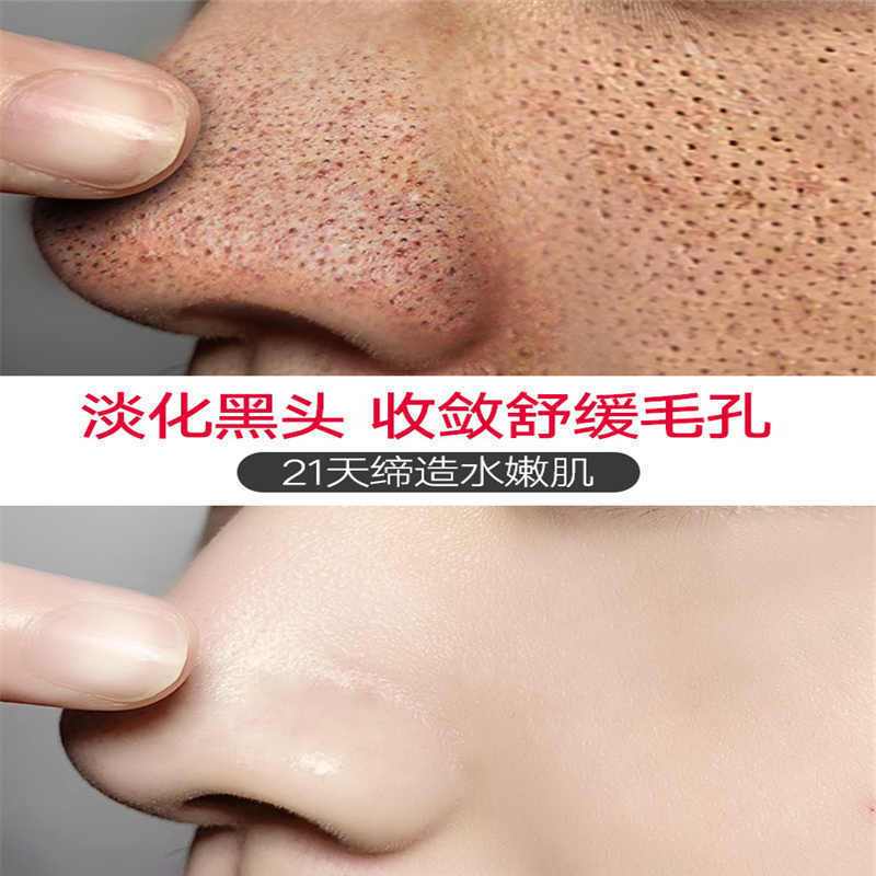 [薇娅推荐]告别毛孔粗大 收缩毛孔嫩肤白肌 乳糖酸补水精华液 乳糖酸[1盒体验] 给毛孔洗澡 适合粗大毛孔黑头粉刺白头