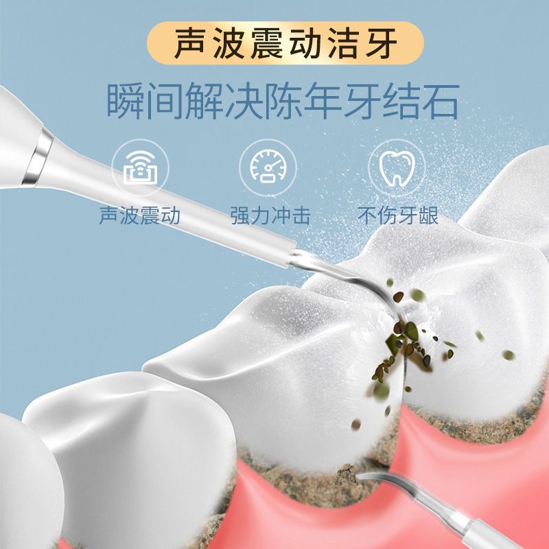 牙结石去除器清理器去牙垢洗牙神器超声波电动家用洁牙器洗牙神器 [电池款]+1头 [靛蓝青]