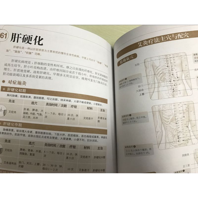 [正版]图解简单艾灸不生病 图解健康大学堂 艾灸治百病中医养生保健大全 经络穴位书籍家庭自我理疗实用教科书
