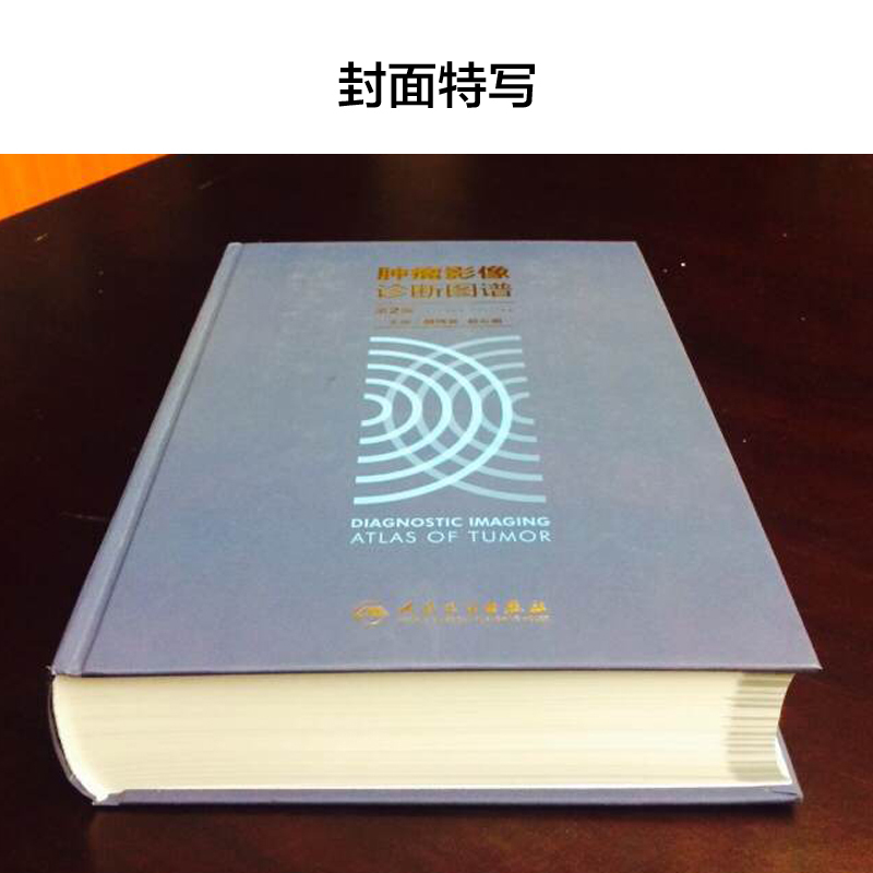 [醉染正版]肿瘤影像诊断图谱 第2版分享中国医学科学院肿瘤医院影像科多年宝贵的诊断与鉴别诊断经验周纯武赵心明主编影像医学