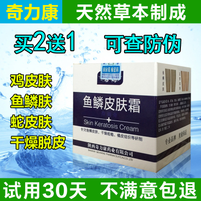 魚鱗皮肤霜蛇皮腿干燥起皮脱皮去鸡皮疙瘩毛囊角化克星病全身体乳