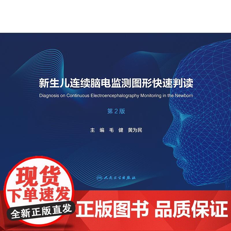 新生儿连续脑电监测图形快速判读(第2版)高清大图