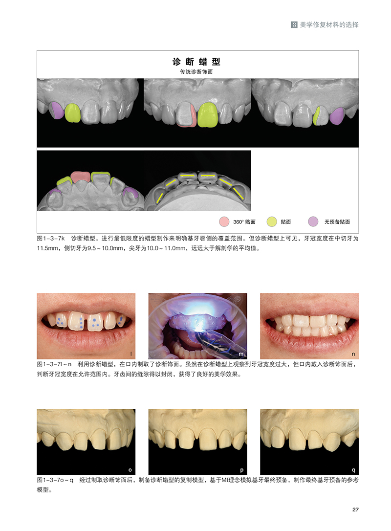 单本全册 [正版] 牙科美学概念 与牙科技师共同创造的前牙美学修复 都築優治著 口腔前牙美学修复体制作 辽宁科学技术出版高清大图