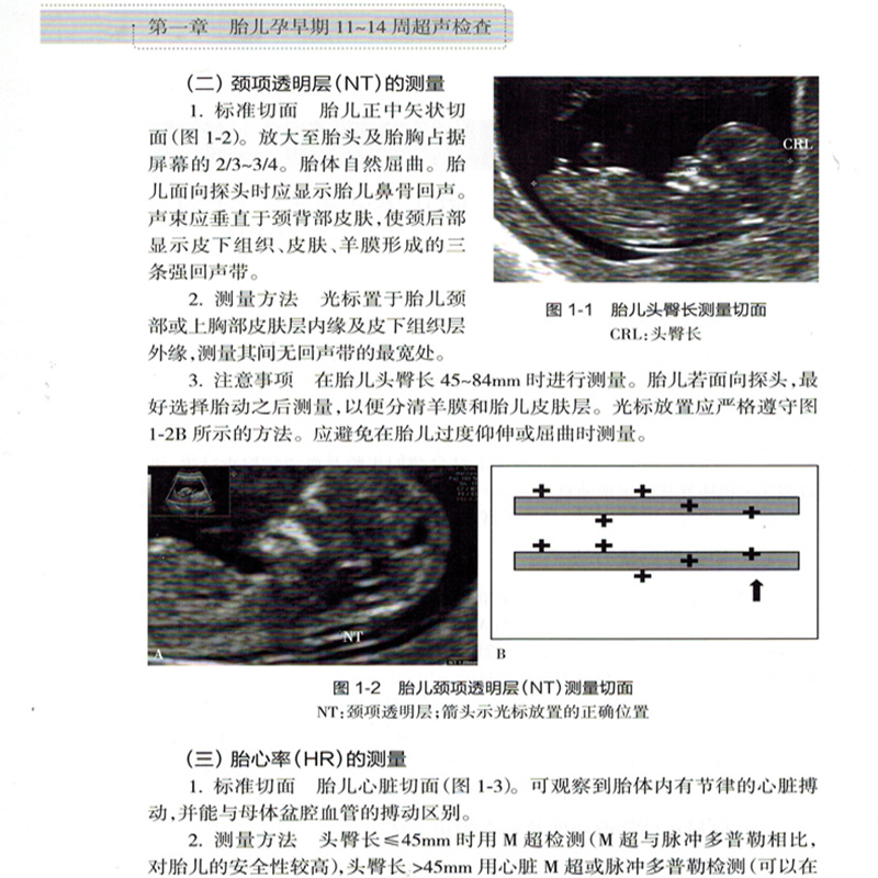 [正版]2本套 中国胎儿产前超声检查规范+中国产科超声检查指南 胎儿检查畸形超声诊断遗传病医学书籍临床产科超声诊断 妇高清大图