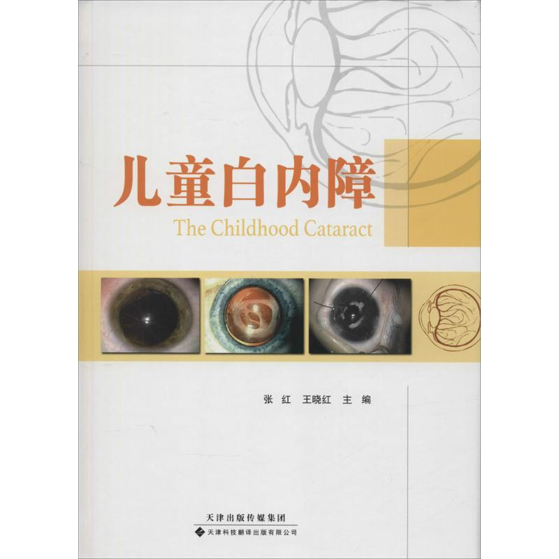 醉染图书儿童白内障9787543332720高清大图