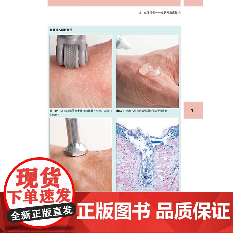 [新书]图解富血小板血浆(PRP)微针再生美容实用指南(德)伯纳德·C科尔斯特附加内容二维码 9787559140579高清大图