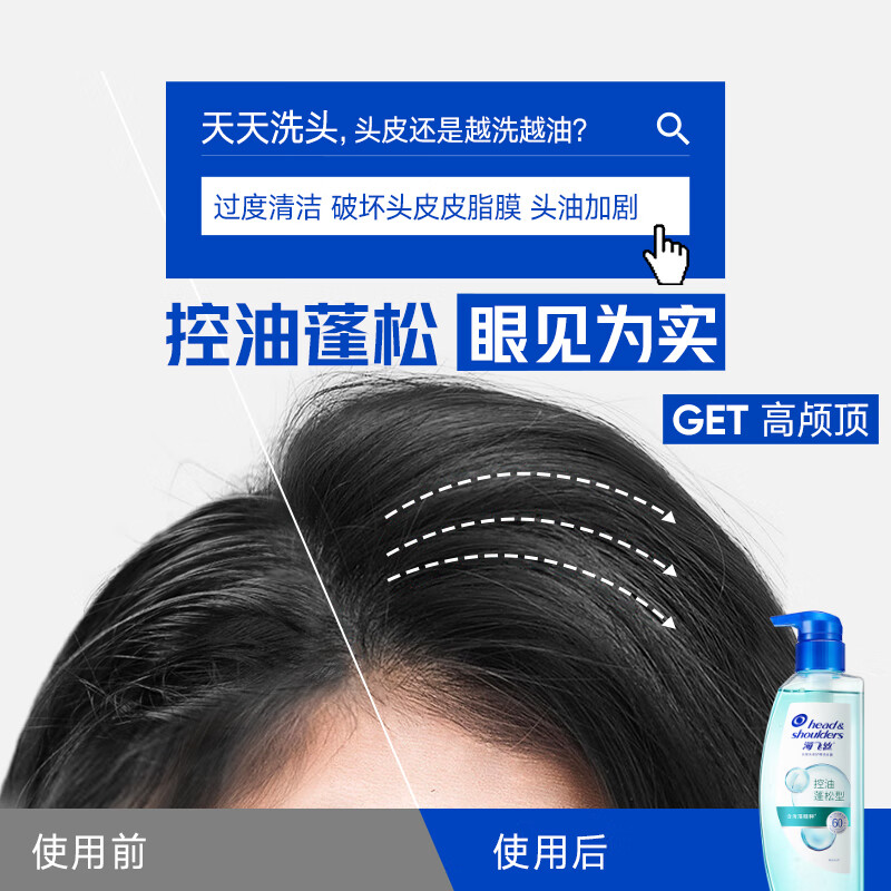 海飞丝 头皮护理洗发水套装 控油蓬松670g+止痒抑屑670g高清大图