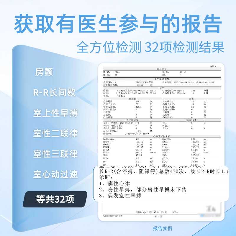 苏宁小Biu 心电监测仪 智能心率血氧检测 24小时动态心电图 蓝牙同步 便携轻巧设计 实时健康预警高清大图