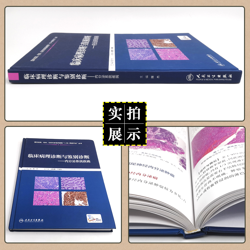 [正版] 临床病理诊断与鉴别诊断 内分泌系统疾病 主编陈杰 人民卫生出版社9787117286824高清大图
