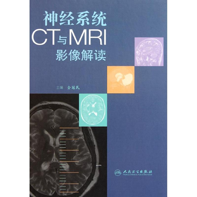 正版新书】神经系统CT与MRI影像解读(包销1000)全冠民97871171431