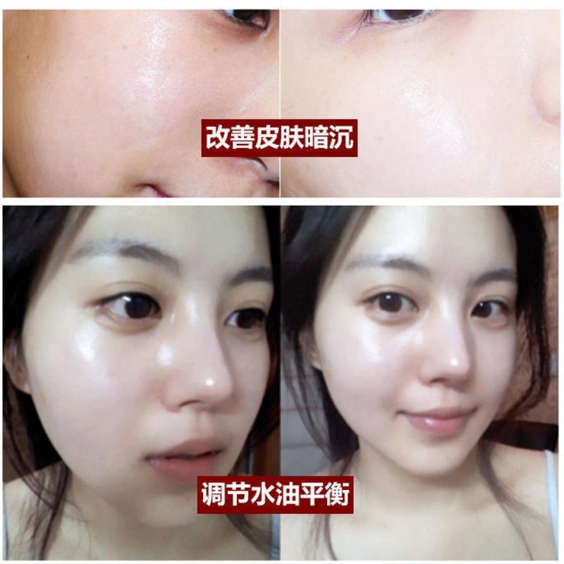 [温碧霞代言]21天美白补水保湿控油护肤品套装化妆品学生女