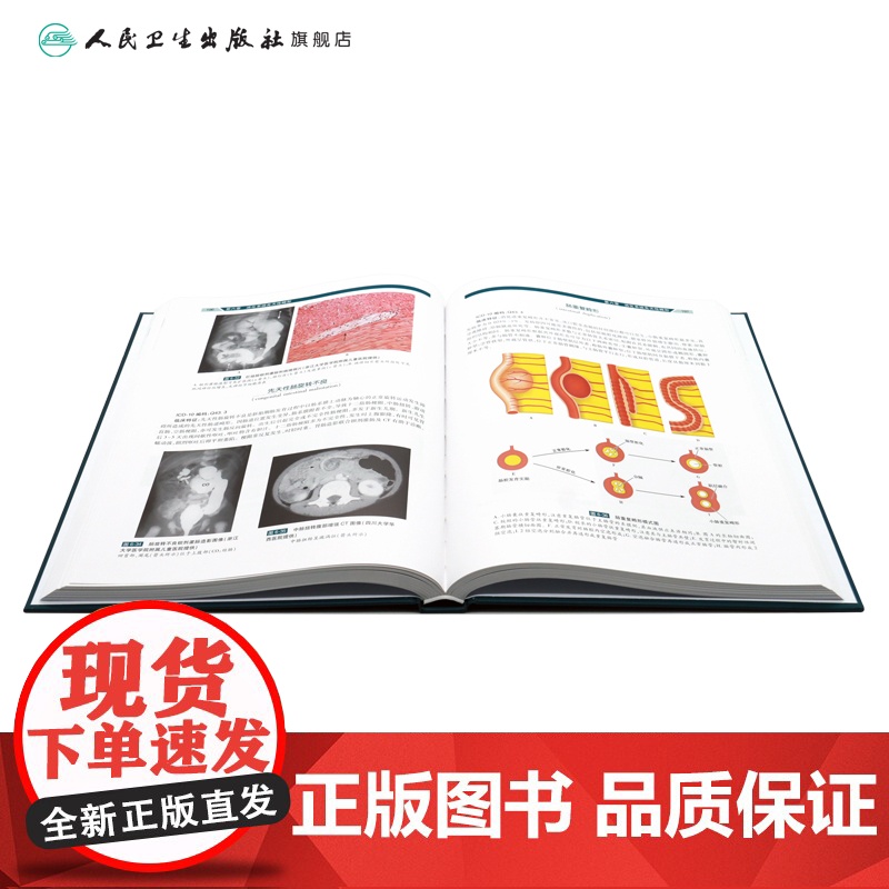 新版 中国出生缺陷图谱 第2二版 刘瀚旻 李胜利 朱军 主编 专科医师核心能力提升引导丛书 人民卫生出版社 978711高清大图