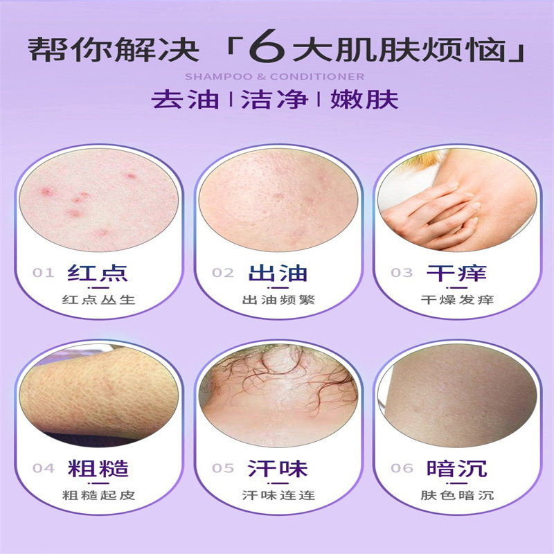隆力奇 清爽滋润沐浴露400ml(单位:瓶)