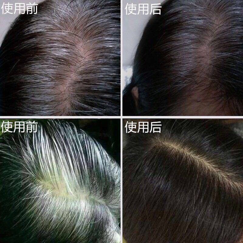 何首乌中草药洗发水白头发转黑发防掉植物养发液