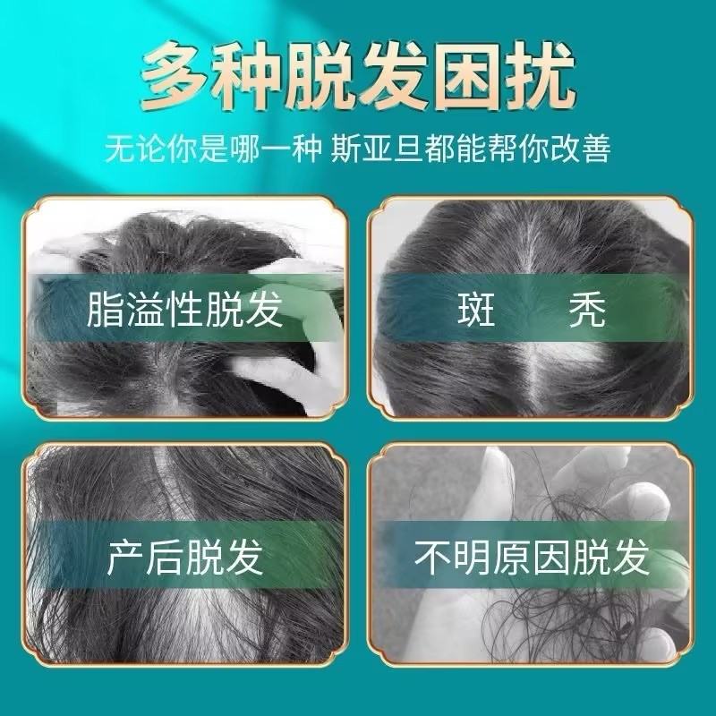 斯亚旦 复方斯亚旦生发酊 75ml/瓶/盒 育发润发固发用于秃发斑秃脂溢性脱发及其它不明原因的脱发液体剂