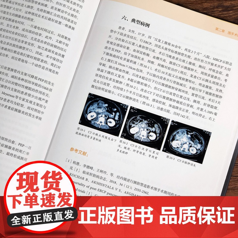 胆胰内镜学ERCP并发症 张筱凤 胆道疾病内窥镜检胰腺疾病造影 消化科内镜科胆道胰腺科等从业人员提供ERCP诊断和治疗的高清大图
