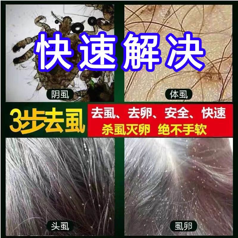 单盒喷剂[送篦子浴帽] 小孩儿童头发头虱去阴虱灭虱卵一扫光孕妇用灭虱卵百部酊去虱神器