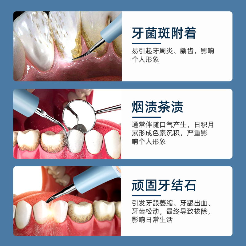 普迈迪超声波洗牙器洁牙仪蓝色款家用牙结石去除洗牙齿污垢电动除牙垢