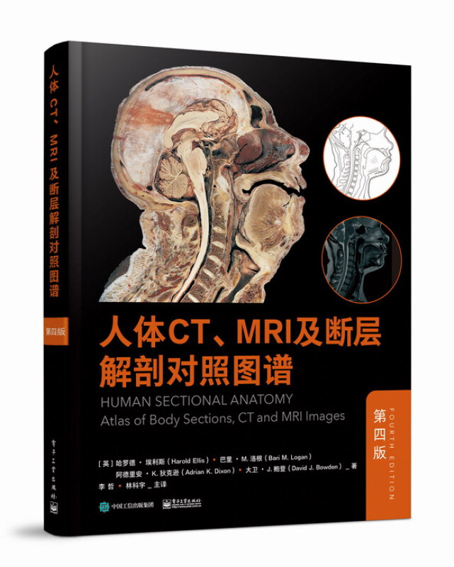 [醉染正版]人体CT、MRI及断层解剖对照图谱(第四版)第4版放射科医生放射技师外科医生培训临床实践临床医学人体解剖学高清大图