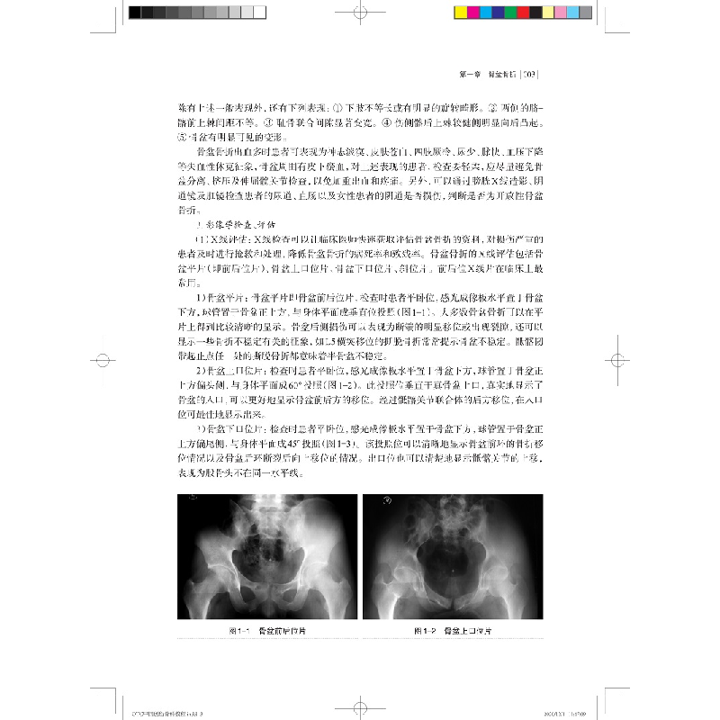 醉染图书OTC中国创伤骨科教程(第二版)9787547850879高清大图