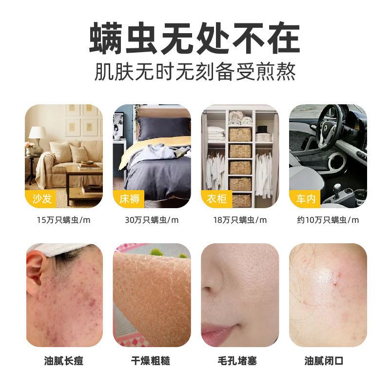 科凌虫控除螨皂拉丝洁面祛痘除螨虫面部女清洗深层清洁手工香皂男 1快装(送起泡网)