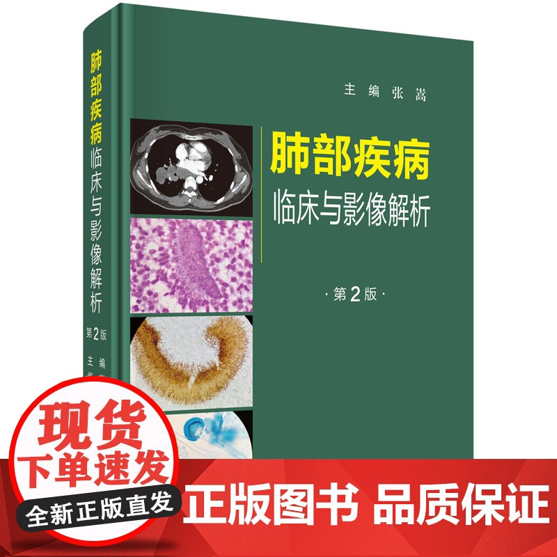 肺部疾病临床与影像解析(第二版) 预计发货06.09