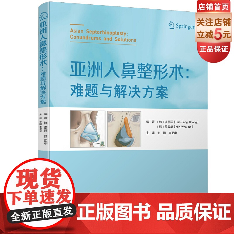 亚洲人鼻整形术 难题与解决方案 鼻整形 组织去除 组织填充 北京科学技术