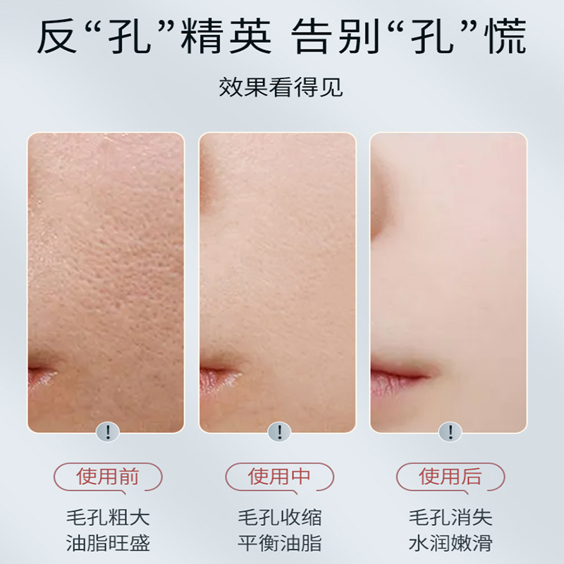 可可丽人水杨酸精华液收缩毛孔粗大修复收敛毛孔刷酸祛痘印闭口女男士正品