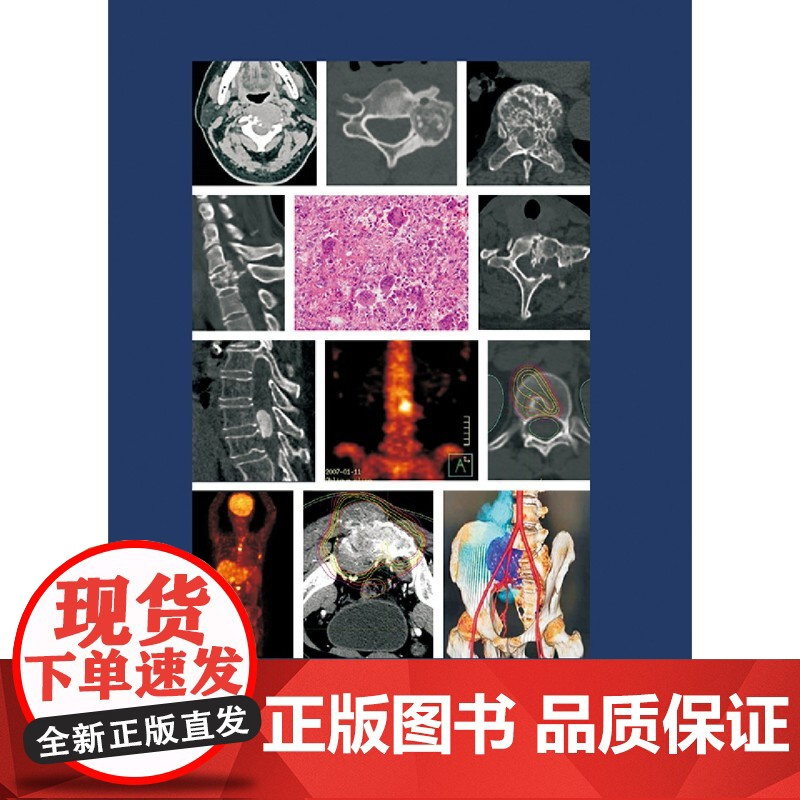 实用脊柱肿瘤学