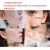 兰蔻(LANCOME)小黑瓶面部精华肌底液 第二代 50ml 保湿补水滋润修护强韧肌底精华液