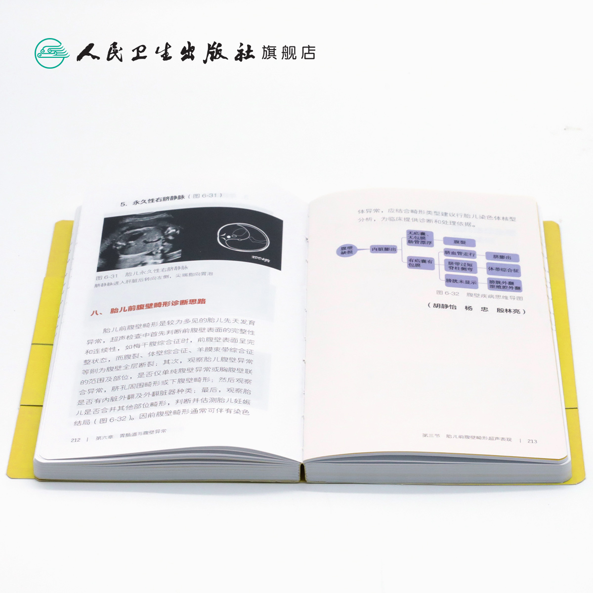 [正版]产前超声掌中宝 邓学东遗传疾病检查胎儿心脏超声诊断筛查妇产科超声检查护理人民卫生出版社胎儿畸形产前诊断学产科超高清大图