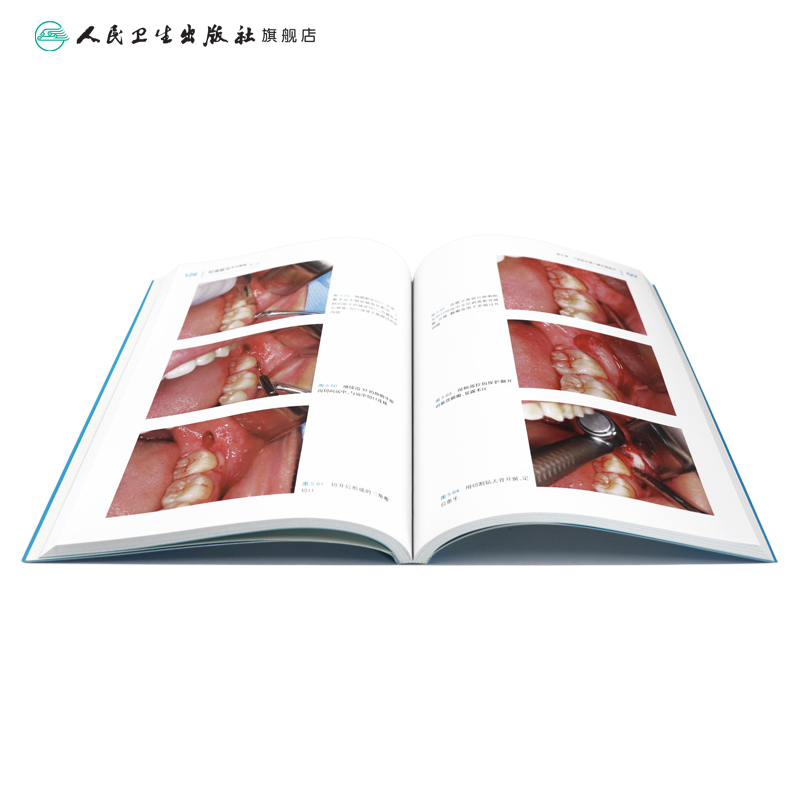 [正版]根管治疗图谱 第二版彭彬牙科正畸种植基础知识失败的真实原因一步一步做好医学儿童修复牙周病学专业人民卫生出版社口