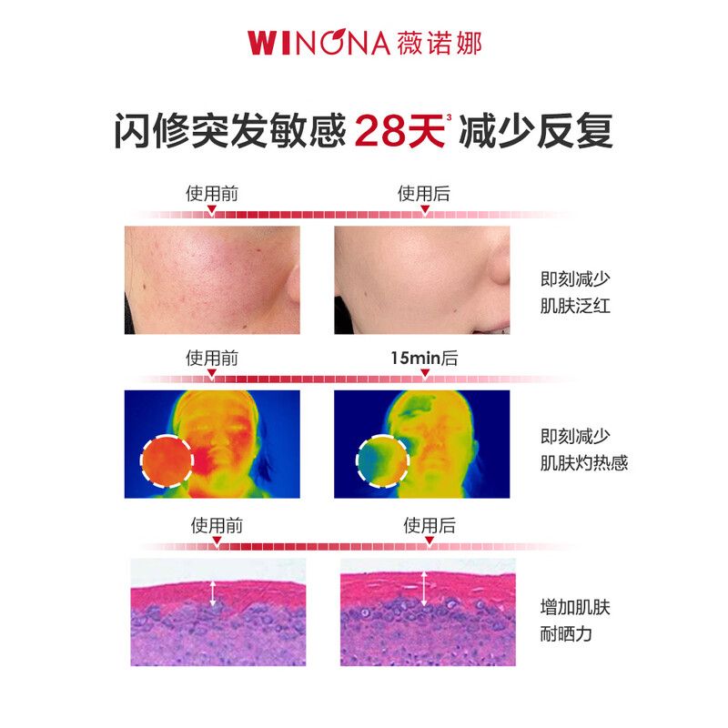 薇诺娜50g舒敏保湿特护霜 第二代高清大图