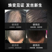 汇仁搏铭防脱育发洗发露 防脱洗发水生姜精华修护强韧控油滋养头皮洗发膏官方正品