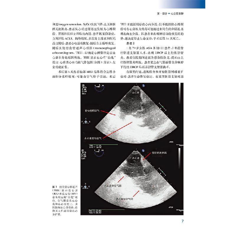 醉染图书麻醉与镇痛病例报道精选1009787519265717高清大图