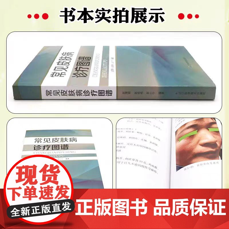 正版 常见皮肤病诊疗图谱 辽宁科学技术出版社 9787559131935高清大图