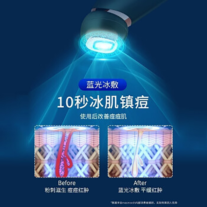 Mesmooth 美容仪器脸部按摩仪提拉紧致家用洁面面部导入仪眼部嫩肤清洁导出 鎏金粉