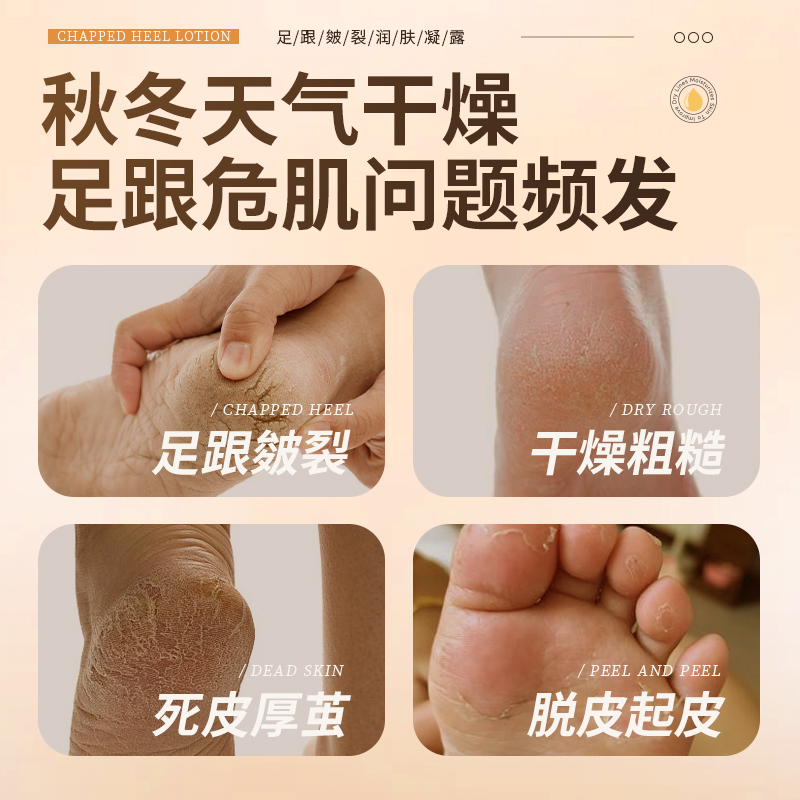 【买1赠1 足部保湿】FONCE梵西 足跟皴裂润肤凝露 多重保湿（凡士林、角鲨烷、牛油果成分） 滑嫩足跟、手肘 60m高清大图