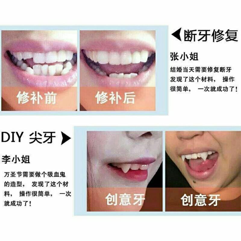 临时假牙补牙洞自己补牙齿补牙缝牙齿材料假牙材料补缺牙齿 5ml(5颗牙左右)