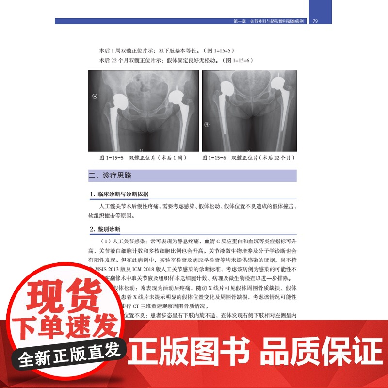 [店]骨科疑难病例精选高清大图
