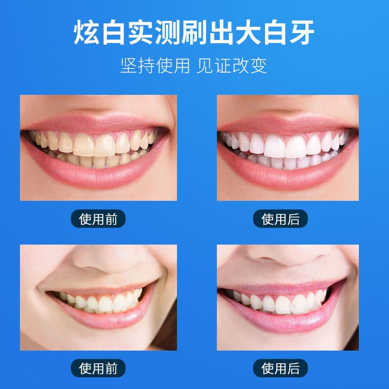 烟酰胺亮白牙粉 仁和旗舰店正品保障[防伪可查] 仁和烟酰胺亮白牙粉美白去黄去口臭去牙结石牙垢烟渍速效清洁牙齿